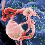 Aggressive HIV strain emerges in Caribbean region