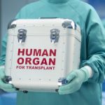 Human organ transplants in the Cayman Islands