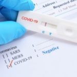 Daily COVID-19 test results all negative