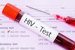 Testing remains key in fight against HIV